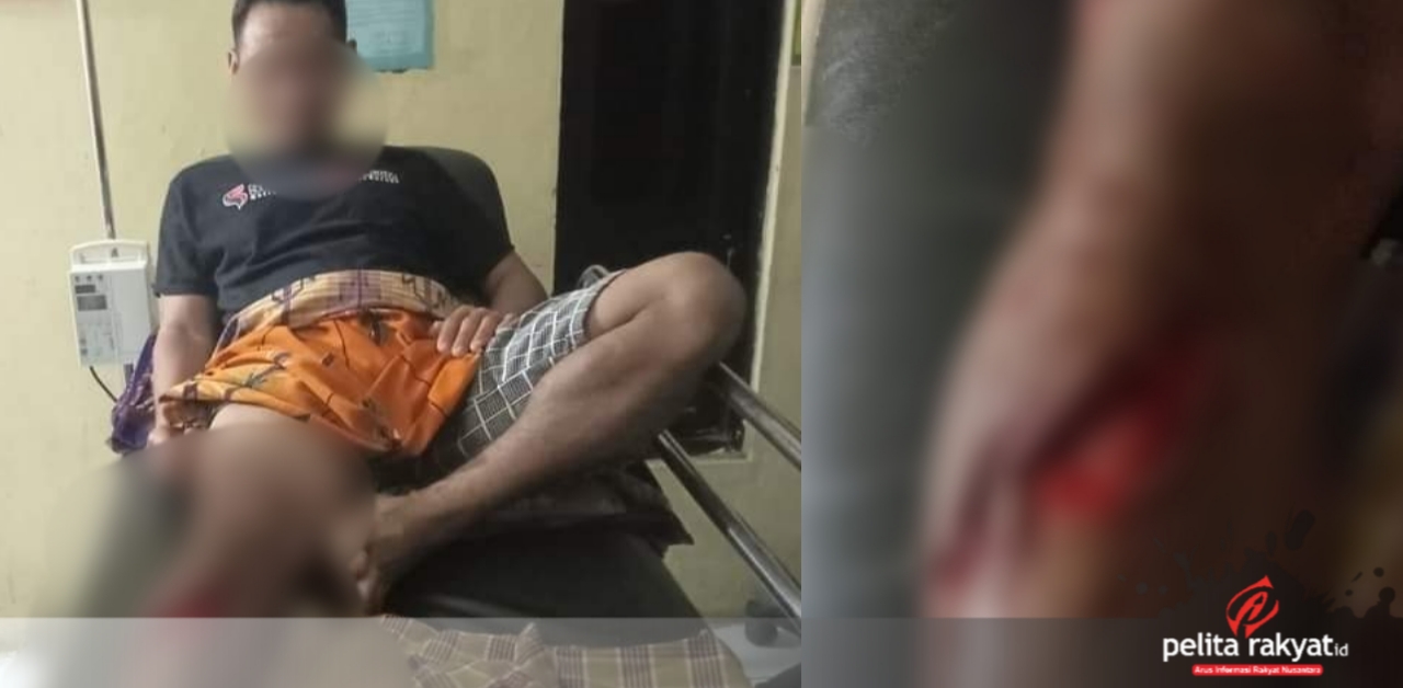 Warga Desa Tugondeng, Hasanuddin yang menjadi korban terkaman buaya.