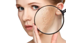 Kulit Kering? Begini Cara Mencegahnya!